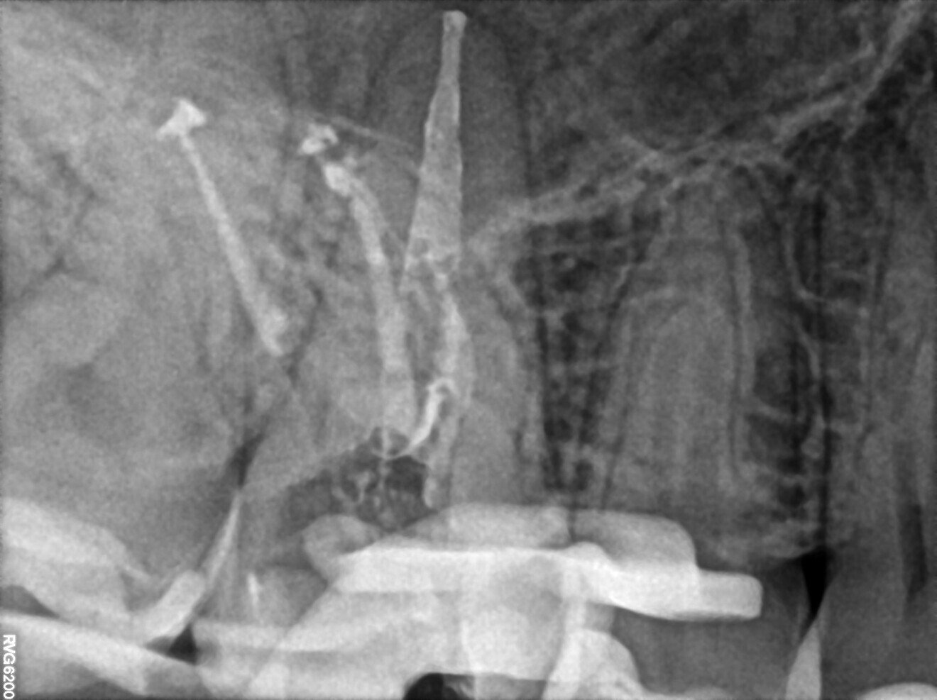 Fig.13