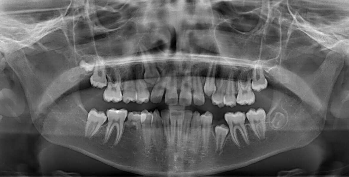 Fig. 12