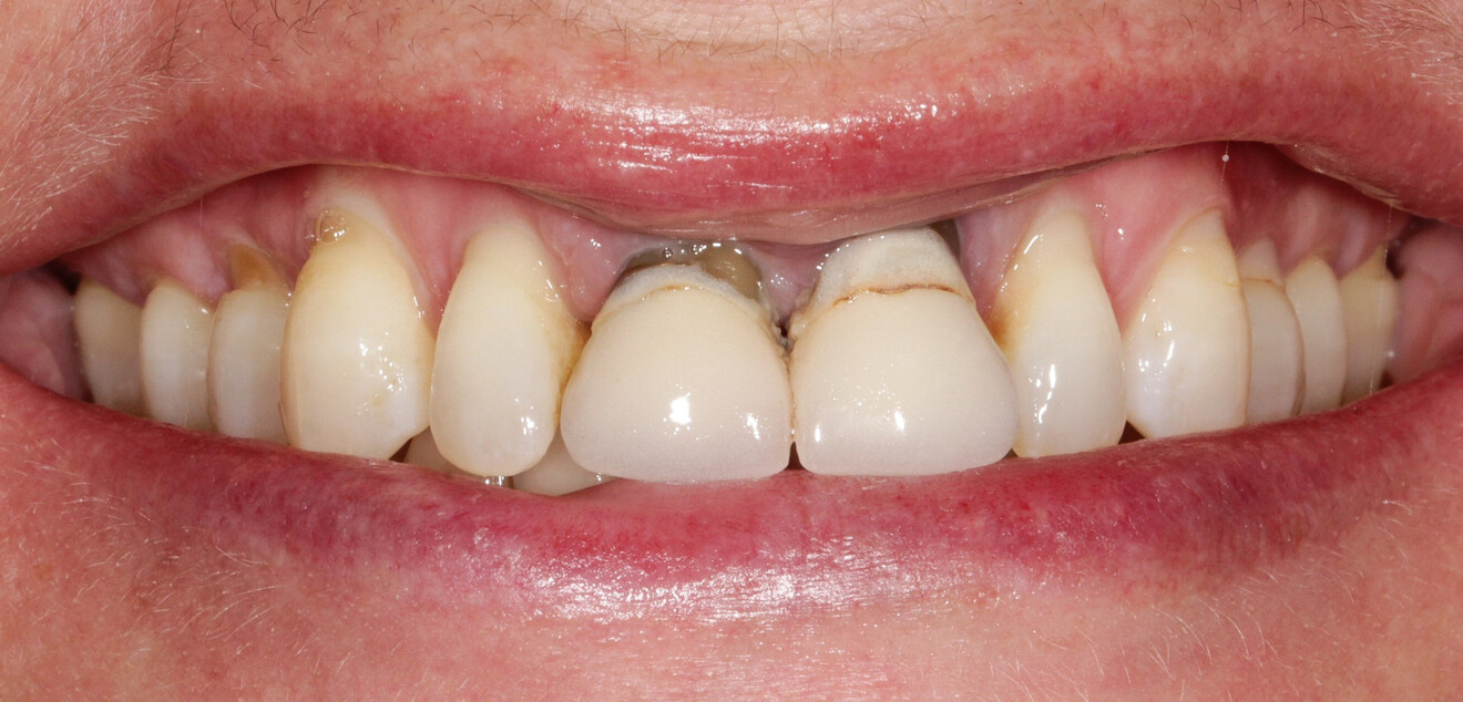 Fig. 7