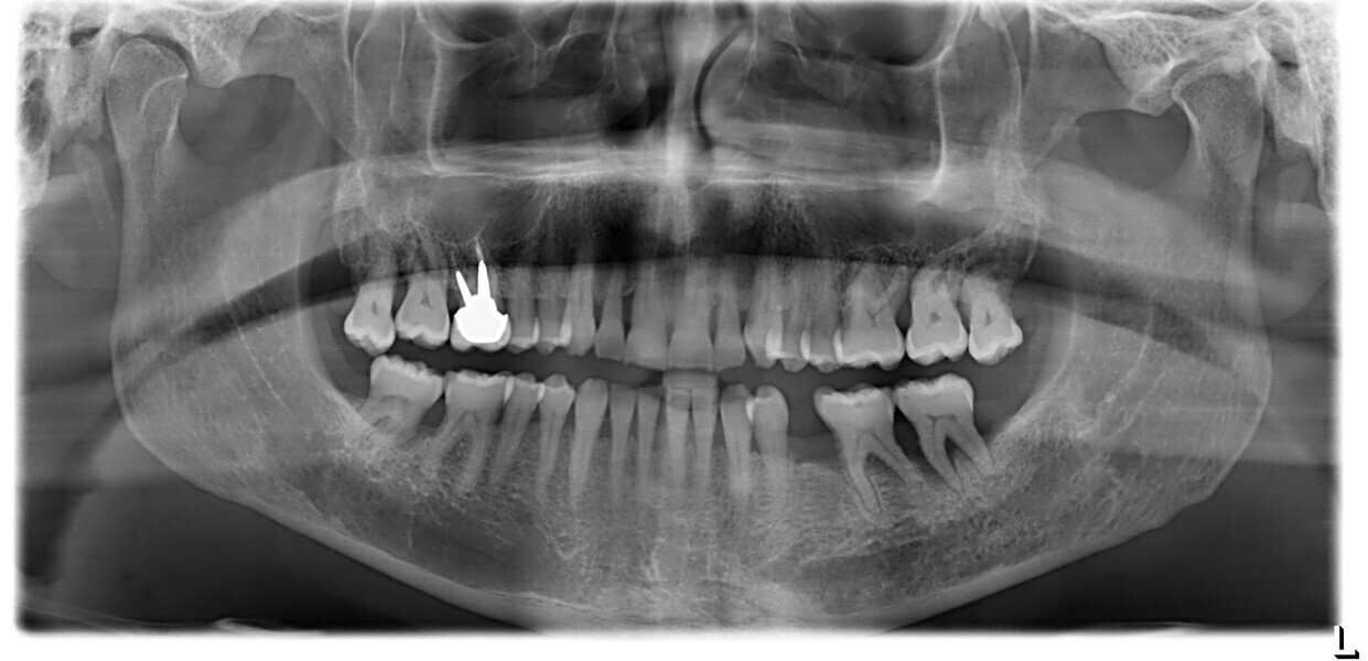 Fig. 13b