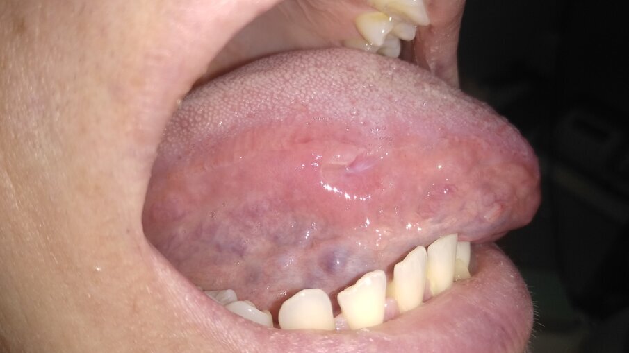 Fig. 4