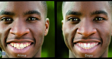 Projecting a new smile from a facial photograph: A new way to plan multidisciplinarydental treatments