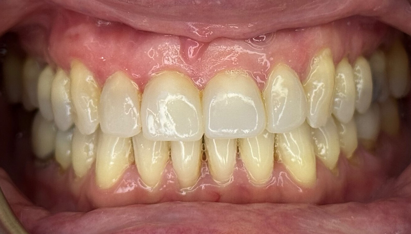 Fig. 6b