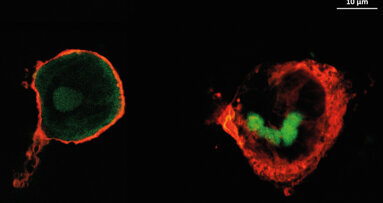 Des revêtements anti-inflammatoires pour réduire les complications post-opératoires implantaires