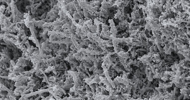 Projekt „MinOroBiome“ untersucht bakterielle Biofilme im Mund