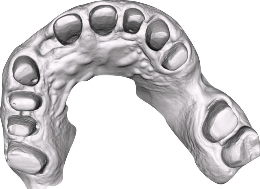 Fig. 13