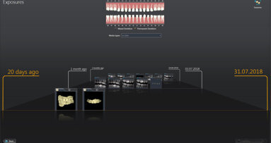 Meeting users’ needs: Dentsply Sirona releases Sidexis 4 V 4.3 and updates Orthophos SL