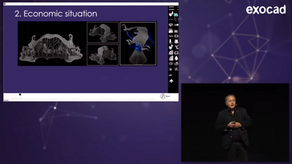 exocad – INSIGHTS 2018: Digital Partial Dentures with PartialCAD by Michael Anger