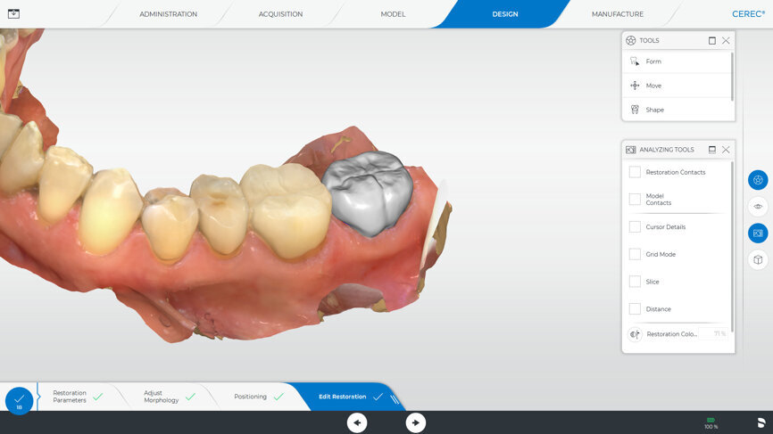 Fig. 4: The user interface for designing the restoration, which can be operated via the touch screen.