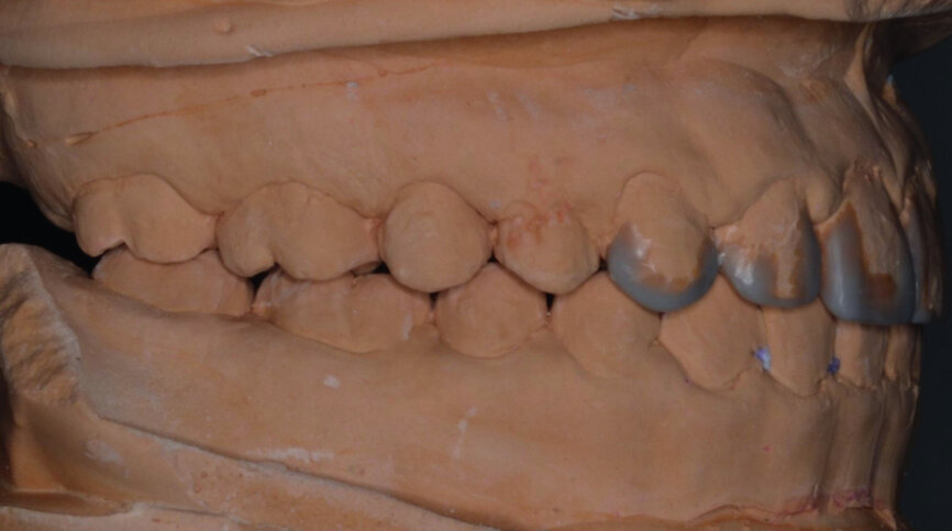 Fig. 38
