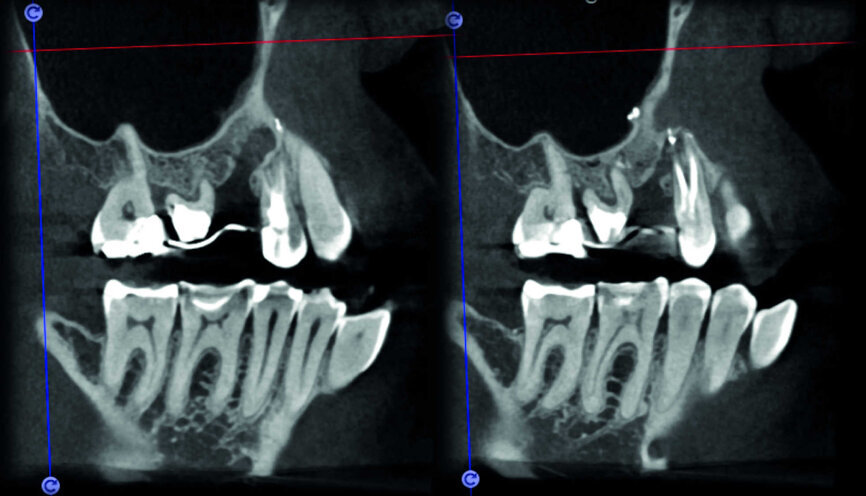 Figure 24
