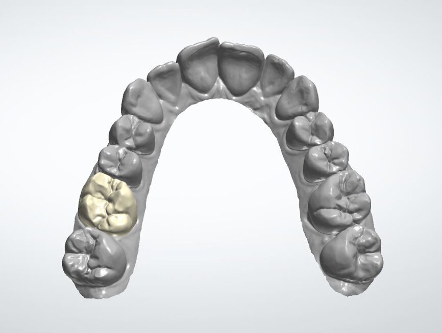 16 vue occlusale