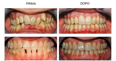 Una consulenza online di qualità per offrire il trattamento Invisalign® ai propri pazienti