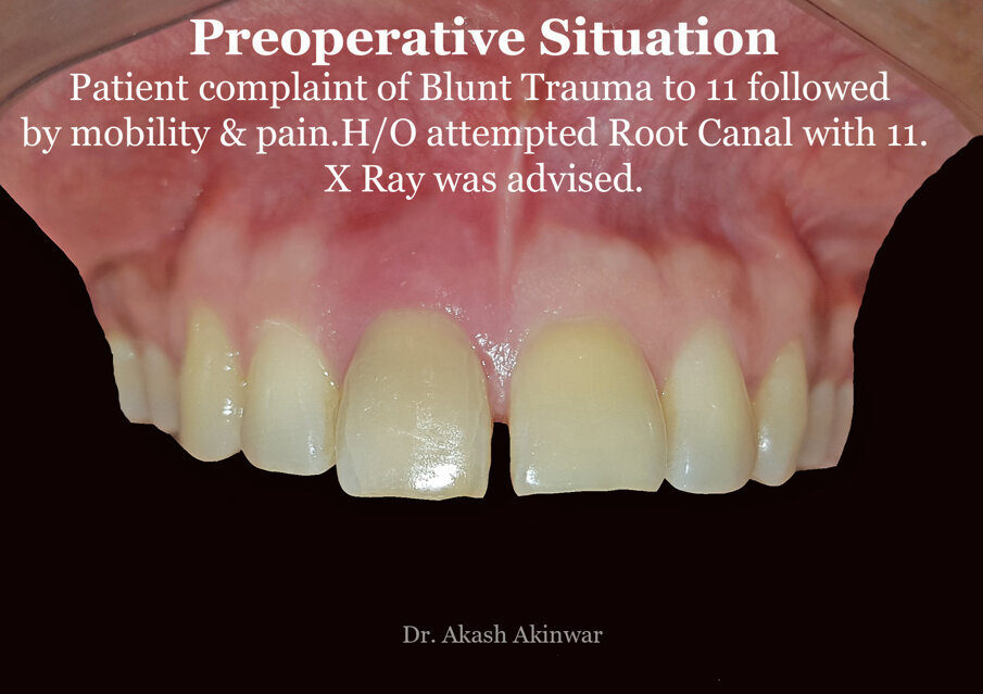 Fig 2: Pre-operative situation of 11
