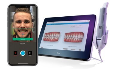 Benefits of Invisalign Smile Architect