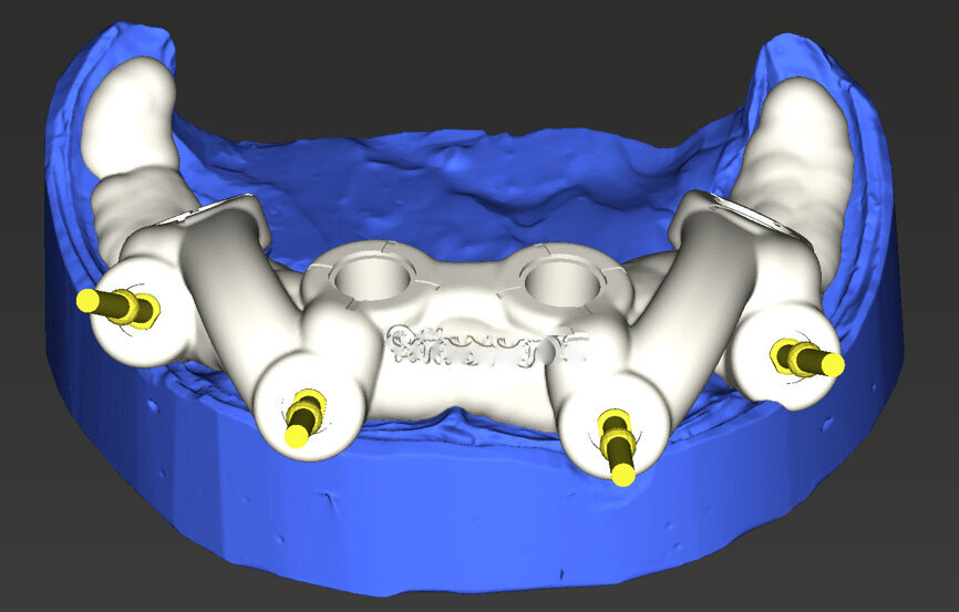 Fig. 7