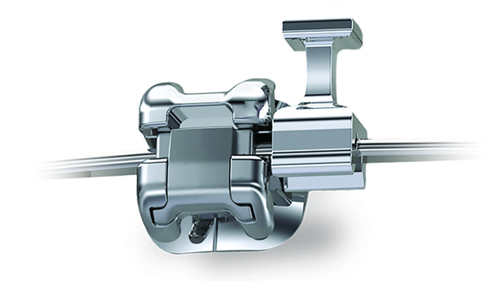 Ormco announces launch of the first and only repositionable hook on the market