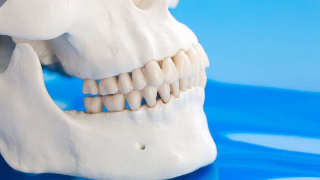 Orthopaedic treatment in Class II cases—clinical considerations