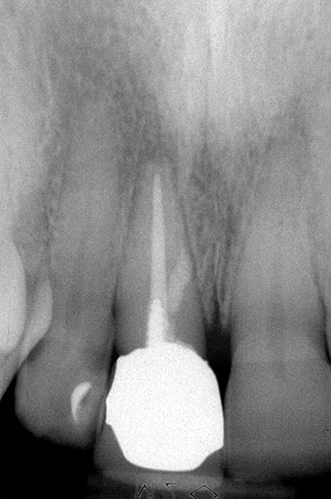 Fig. 2f