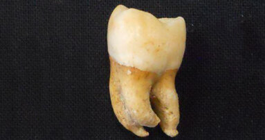 Researchers develop new method to determine biological sex of human skeletal remains