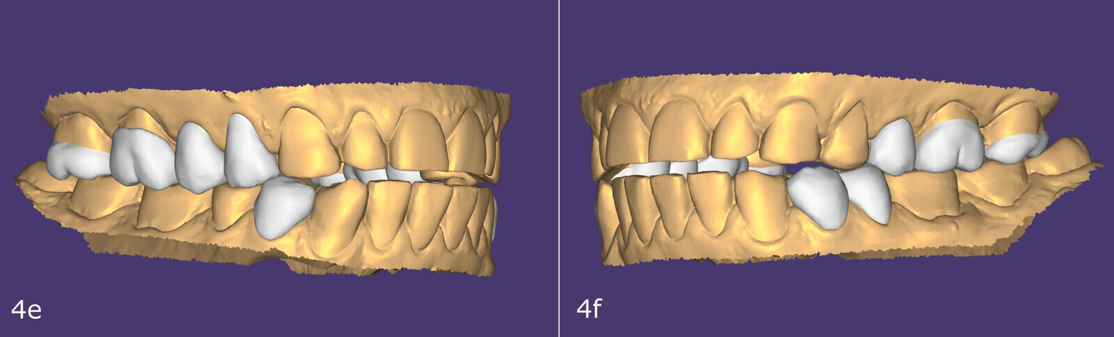 Figs. 4e–f.