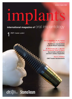 implants Czech Republic No. 1, 2021