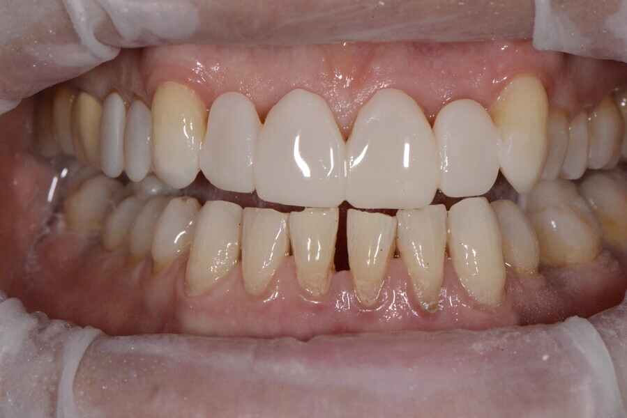 Fig. 15b