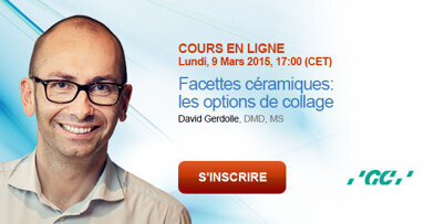 Webinaire « Facettes céramiques: les options de collage »