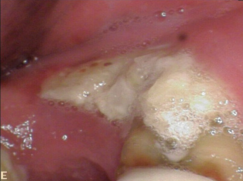 Fig. 12c