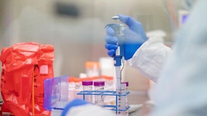 How to make use of Antigen Tests for Covid-19? How do antigen tests differ from RT PCR?