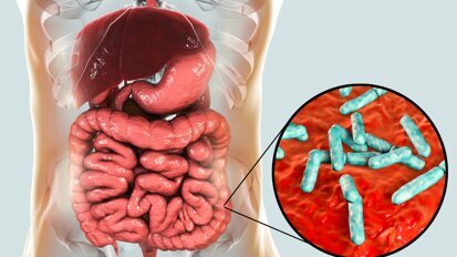 Periodontitis can disrupt gut microbiota by inducing dysbiosis