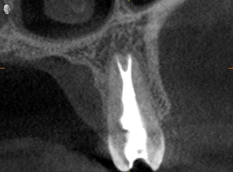 Fig. 21b.