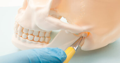 Researchers develop model to automatically localise mandibular canals