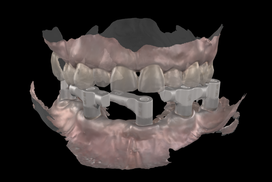 Fig. 12b
