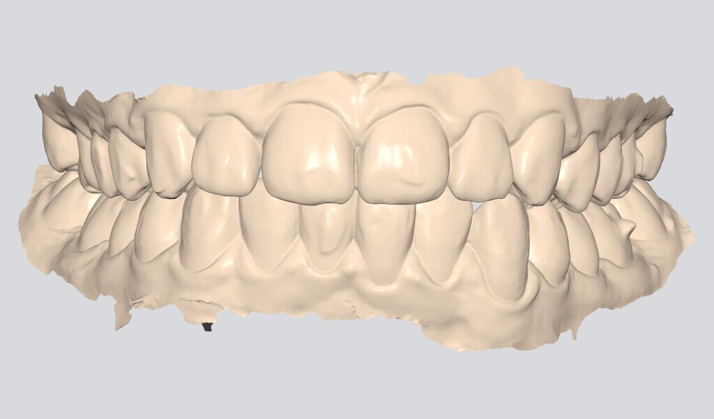 Fig. 19