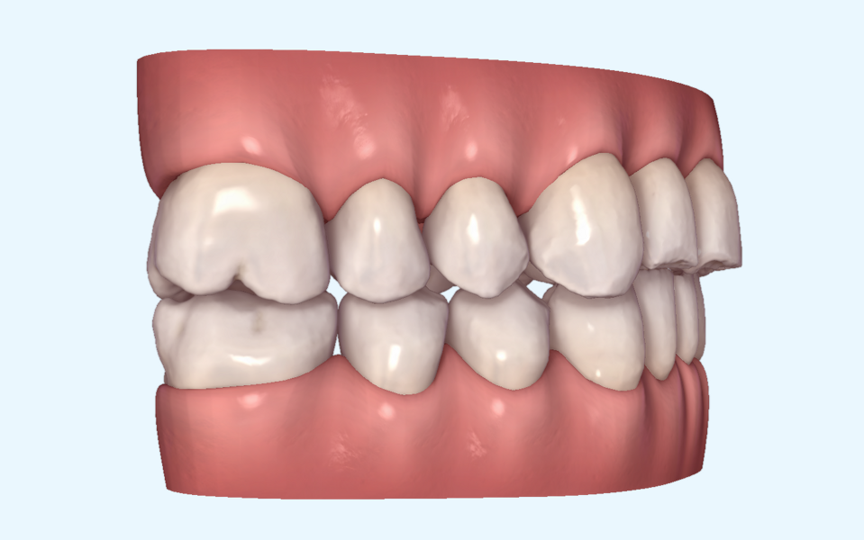 Fig. 18d