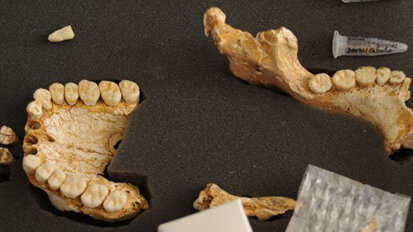Zahnstein enthüllt: Schon Neandertaler nutzten Heilpflanzen