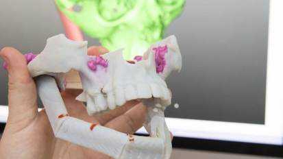 Primer congreso internacional sobre impresión 3-D en medicina