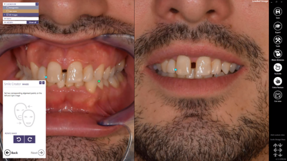exocad – Quick Guide: Learn Smile Creator in 7 min!