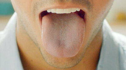 Causes and treatment of breath odour