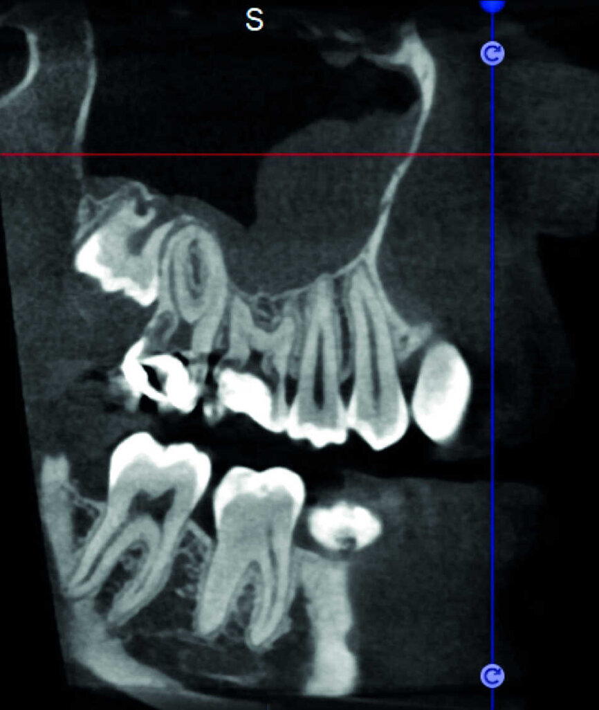 Figure 11