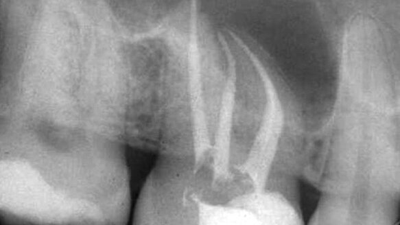 Critical thinking: the missing link in endodontic education