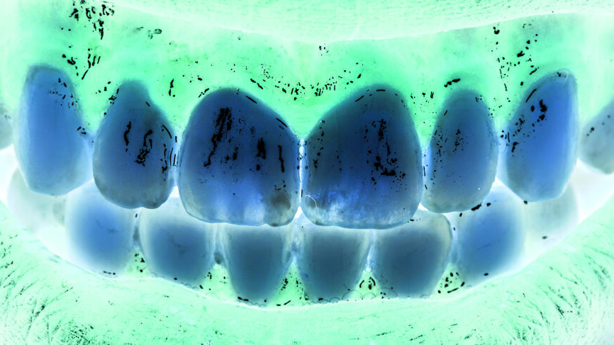 Fig. 17 : Vérification ultime du résultat final sur image inversée (négatif).