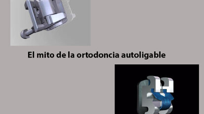 Conferencia online sobre ortodoncia autoligable