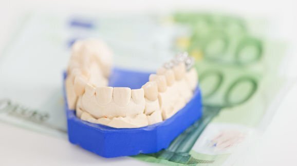 Suécia: opiniões de dentistas sobre comparação de preços de serviço variam