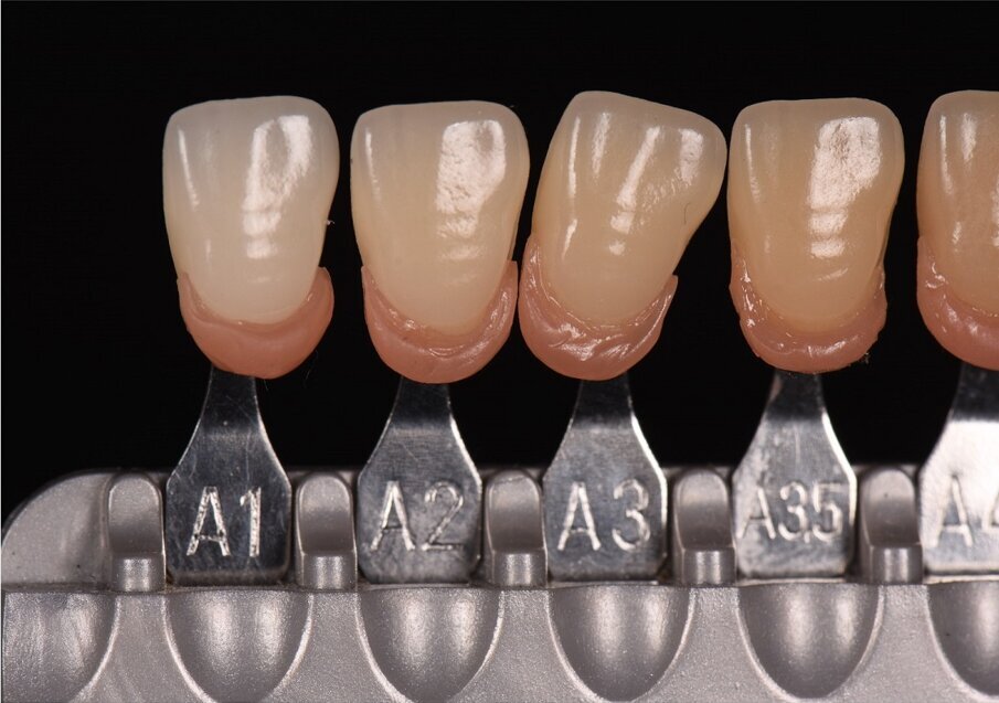 Fig. 1:  VITA classical A1–D4 shade guide with the pink additions to improve its contextuality and increase its efficiency in shade matching.