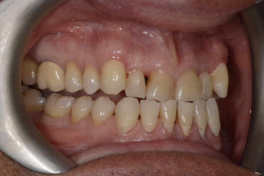 Fig. 11d