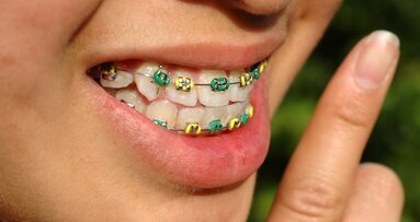Orthodontisten schroeven tarieven op