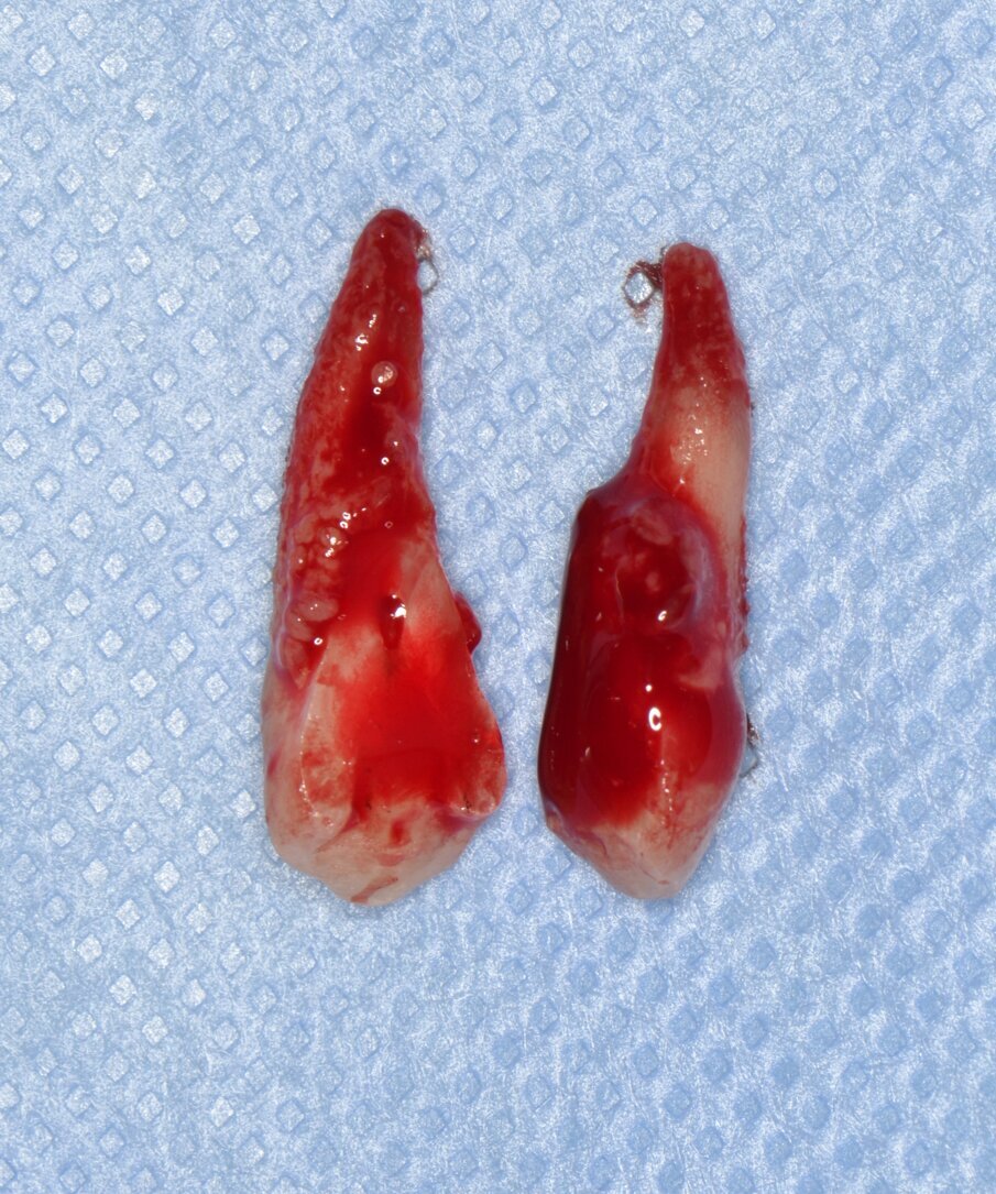 Fig. 6 - Elemento 1.4 estratto.