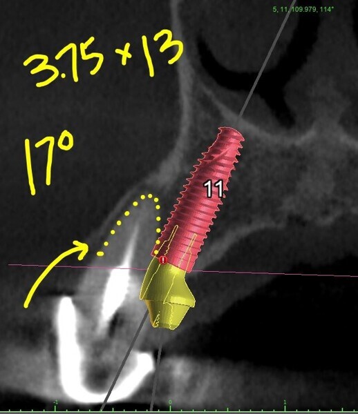 Fig. 4e